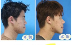 颌面正畸有风险吗