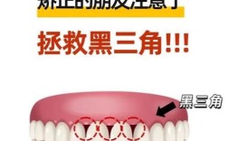 正畸黑三角如何去除