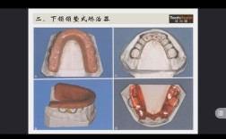 正畸托槽安置器怎么用？新手必看的使用步骤与注意事项详解