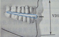 正畸牙弓长度测量