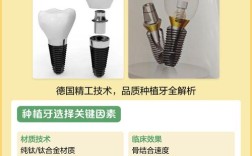 德国种牙品牌哪个好？如何选到靠谱又优质的？