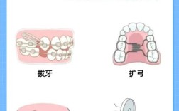 牙齿内收的方法