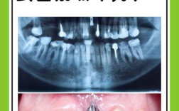 以色列vs韩国种牙，效果、价格、技术如何选？