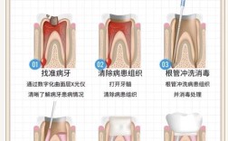 牙髓炎处理方法