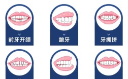 儿童牙齿矫正一般需多久？