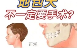 地包天需要矫正牙齿吗？不矫正会有哪些影响？
