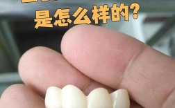 烤瓷冠能配合正畸治疗吗？