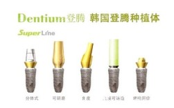 韩国的二种种植牙