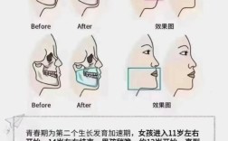 脸型不对称如何矫正？有哪些有效方法推荐？