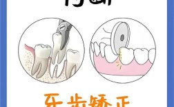 拔牙上四下五正畸