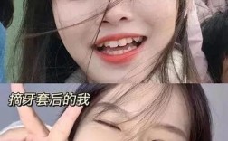 贵阳矫正牙齿去哪里？专业机构+价格与口碑推荐