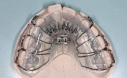 正畸舌簧矫治器的弯制需掌握哪些关键步骤与实用操作技巧？