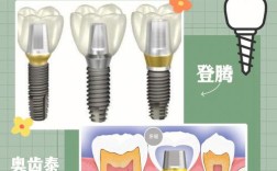 奥齿泰和登腾种植牙到底怎么选？从价格、耐用性到医生适配性全面对比哪个更值得入手？