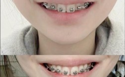 北京口腔王府井 正畸