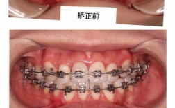 天津一中心正畸效果如何？价格靠谱吗？