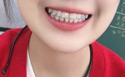 矫正完牙齿戴保持器