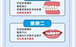 正畸拔牙矫正教学