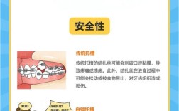 星耀系列正畸托槽