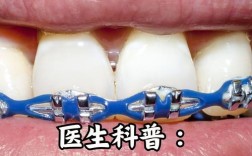 矫正后牙齿松动怎么办？是否属于矫正过程中的正常现象？