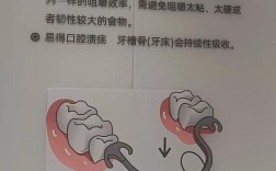 固定修复有哪些方法