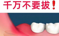 正畸智齿一定要拔吗