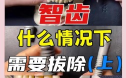 牙齿矫正需要拔掉智齿