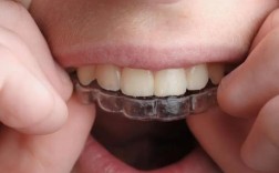 牙齿有点不整齐，矫正真的有必要吗？