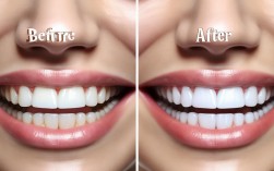 牙齿矫正前后对照，效果差异究竟有多大？