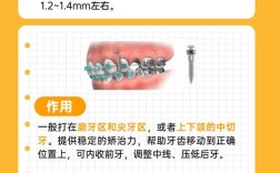 正畸支抗钉大小怎么选才合适？