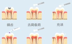补牙和种牙的本质区别是什么？哪种更适合缺牙修复？