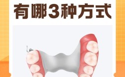 拔牙最迟什么种牙镶牙