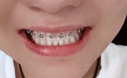 矫正牙齿去哪儿好？专业机构怎么选？效果价格怎么平衡？