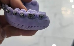 牙科正畸模型展示