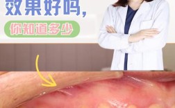 种牙是什么材料好？不同材质的优缺点和选择建议？