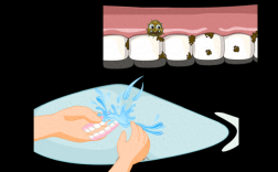 固定义齿如何正确清洁？日常护理方法有哪些？