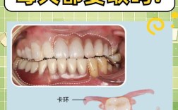 正畸科能安假牙吗