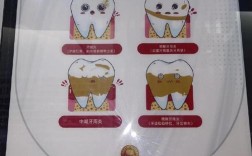 温州牙科牙博士的治疗方法效果如何？安全吗？有什么优势？