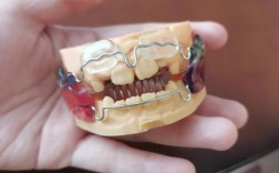 做正畸要用那些器材