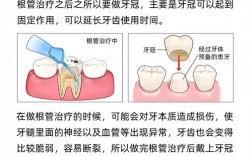 牙龋炎怎么治疗方法