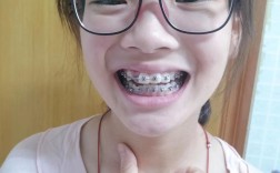 湖州矫正牙齿哪里最好？求本地靠谱诊所推荐！