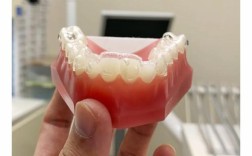 正畸托槽什么牌子好