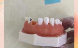 烤瓷牙预备的方法步骤具体有哪些操作要点？