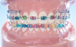 口腔正畸科普视频，你最想知道哪些关键问题？