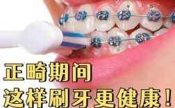 正畸儿童刷牙方法是什么？如何刷干净牙套？