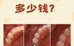 以色列种牙贵么