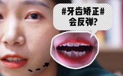 矫正牙齿反弹后牙缝变大，是什么原因造成的呢？该怎么处理？