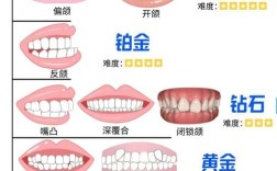 正畸图片大全图解