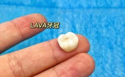 根管治疗后做牙冠正畸