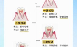 种植牙松动会掉落吗？脱落风险大吗？