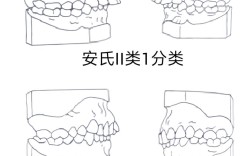 安式错颌的分类方法